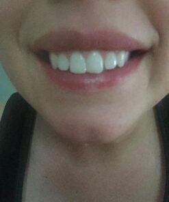 Dental Duty Sensitive Teeth Whitening Strips – Professional Vegan Stain Remover White Strips for Sensitive Teeth for Coffee & Tea Stains – Get A Lighter Shade After One Application – 28 Strips 42 71TguuoZaiL