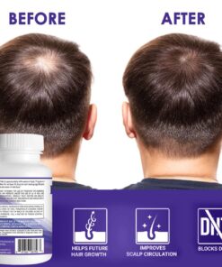 Propidren by HairGenics - DHT Blocker & Hair Growth Capsules to Prevent Hair Loss & Stimulate Hair Follicles, to Stop Hair Loss & Regrow Hair. Proprietary Anti-Hair Loss & Hair Regrowth Treatment. 25 71TsIMgVypL 1