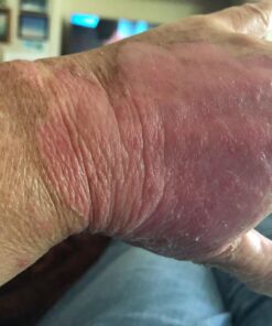 Silver Miracles Colloidal Silver Gel - Nano Silver Gel Wound Care - Healing Ointment for Burns, Sunburns & Irritated Skin - 4 Oz Unscented 46 71Tz9TqiTML 1