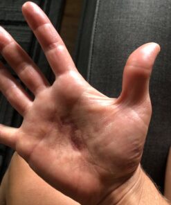 Aidance Skincare & Topical Solutions terrasil Anti-fungal Treatment MAX - 50g 27 71UDpj1La1L