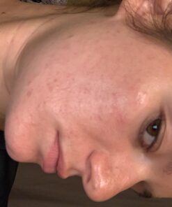 TruSkin Tea Tree Clear Skin Super Serum, Formulated with Tea Tree Oil, Vitamin C, Salicylic Acid, Niacinamide & Retinol, 1fl oz 1 Fl Oz (Pack of 1) 56 71UEOBsw90L 1