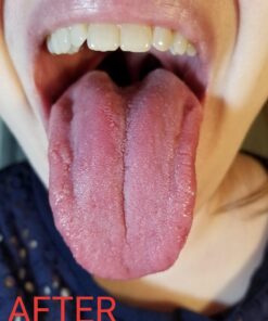 Orabrush Tongue Scraper, Tongue Cleaner Helps Fight Bad Breath, 4 Tongue Scrapers 4 Count (Pack of 1) Multicolored 31 71UTG6Ji4wL