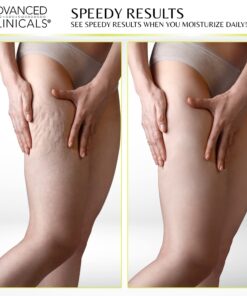 Advanced Clinicals Green Coffee Bean Lift & Slim Body Cream Skin Care Anti Cellulite Cream | Caffeine Body Lotion Balm To Firm, Tighten, & Hydrate Look Of Legs, Arms, Tummy, Butt, & Thighs, 16 Ounce 16 Ounce (Pack of 1) 25 71Uq2jFVCjL 3