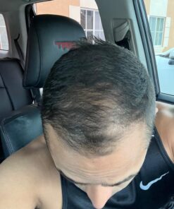 Nutrafol Men's Hair Growth Supplements, Clinically Tested for Visibly Thicker Hair and Scalp Coverage, Dermatologist Recommended - 1 Month Supply 47 71UrL6Ga9VL