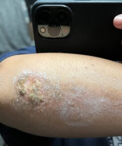 Active Skin Repair Hydrogel - Natural & Non-Toxic First Aid Ointment & Antiseptic Gel for Minor Cuts, Wounds, Scrapes, Rashes, Sunburns, and Other Skin Irritations (Single, 3 oz Gel) 3 Fl Oz (Pack of 1) 43 71VH2cYa51L