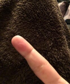 Compound W Nitrofreeze | Wart Removal | 1 Pen & 5 Replaceable Tips 46 71VNtYL9LmL 2