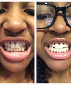 Whitening Tooth Powder with Activated Charcoal for Teeth and Gums (Cool Peppermint) - Safe on Enamel, Detoxifying, Plant-Based and Cruelty Free 2.75 Ounce (Pack of 1) 32 71VPPJVDnTL