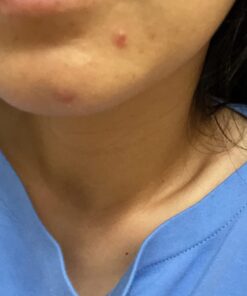 Naturenetics HairAnew Hair Growth Vitamins for Women & Men - Hair Vitamins For Faster Hair Growth & Thickness - Part of Proceeds go to Hair Loss Charity - Vegan Hair Supplement For Hair Skin Nails (1) 1 38 71VUeVYgx0L