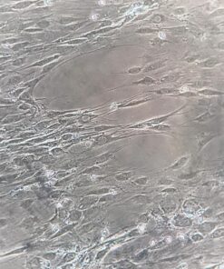 Celestron – NexYZ – 3–Axis Universal Smartphone Adapter for Telescope – Digiscoping Smartphone Adapter – Capture Images and Video Through Your Telescope or Spotting Scope NeXYZ 3-Axis Smartphone Adapter 37 71VXTsO4e1L