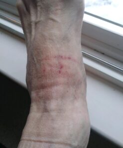 Heel Cups, Plantar Fasciitis Inserts, Heel Pads Cushion (3 Pairs, FSA or HSA Eligible) Great for Heel Pain, Heal Dry Cracked Heels, Achilles Tendinitis, for Men & Women. (Gel Heel Cups) White(3 Pairs) 37 71W0L4aKO9L 3