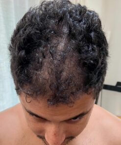 6 Months Kirkland Minoxidil 5% Extra Strength Hair Loss Regrowth Treatment Men, 12 Fl Oz (Pack of 6) 39 71Wc408zCjL