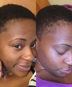 OETUIOW Gala Purity Emu Oil - Large 4oz - Best Natural Oil for Face, Skin, Hair Growth, Stretch Marks, Scars, Nails, Muscle & Joint Pain, and More,SG_B00V7AGZGU_US 11 71X7RObS4vL