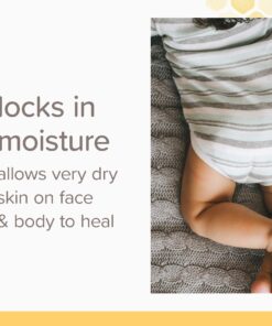 Burt's Bees Baby Diaper Balm, Multipurpose Healing Ointment Softens & Calms Dry Skin, Eczema Safe, with Shea Butter, Plant Based Formula, Pediatrician Tested, 7.5 Oz 7.5 Ounce (Pack of 1) 37 71XJ7ZCwQaL 1