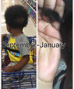 Wild Growth Hair Care System, 4 Fl Oz (Pack of 2) 31 71XQXRbg0qL