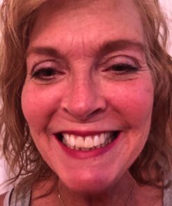 Dental Hygiene Kit - Calculus & Plaque Remover Dental Tool Set - Stainless Steel Tarter Scraper, Tooth Pick, and Mouth Mirror - Dentist Instrument Set for Teeth Cleaning (Blue) Blue 41 71Xsljrf4VL