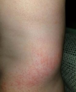 Culligan WSH-C125 Wall-Mounted Filtered Showerhead with Massage, 10,000 Gallon, Chrome, 8.5"L x 4.75"W 29 71Y9r pmvjL