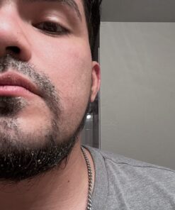 Era Organics Microdermabrasion Facial Scrub & Face Exfoliator - Spa Quality Exfoliating Mask with Manuka Honey Walnut Moisturizing Exfoliant for Dry Skin, Blackheads Wrinkles (2 oz) 2 Ounce (Pack of 1) 35 71YZvO7nibL