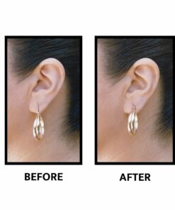 Lobe Wonder - The ORIGINAL Ear Lobe Support Patch for Pierced Ears - Eliminates the Look of Torn or Stretched Piercings - Protects Healthy Ear Lobes from Tearing - 60 Patches - Clear & Latex-Free 27 71ZetZ y7hL