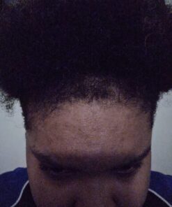 Intensive Biotin Hair Growth Serum - Spray - Hair Loss, Receding Hairline & Pattern Baldness Treatment For Women & Men With Thinning Hair - Dht Blocker - Sulfate-Free by Amplixin (2oz) Biotin Serum 29 71ZhVKEB L 3