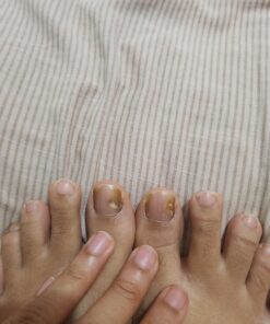 Kerasal Nail Renewal, Restores Appearance of Discolored or Damaged Nails, 0.33 fl oz (Packaging May Vary) 43 71ZyNnWYi L