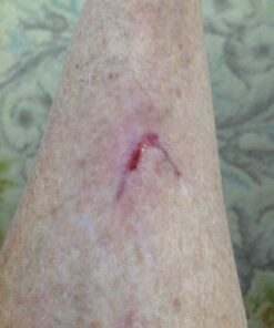 Convatec Duoderm CGF Wound Dressing, 5 Count 4x4 10cm x 10cm Natural 4"x4", 5ct Box (Pack of 1) 17 71aJb59iibL