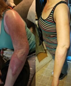 Collagen Peptides Powder - Grass Fed, Pasture Raised with Aminos - Promotes Healthy Skin Hair & Nails – Bone & Joint Support - Hydrolyzed, Unflavored, Non GMO, Gluten Free - Easy to Mix -16 oz 39 71aKnTRUqeL