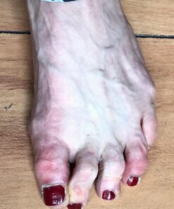 5 STARS UNITED Toe Spacers for Men and Women – 4 Gel Toe Separators for Curled and Overlapping Toes, Bunions, Hammer Toe Straightener, Big and Second Toe Spreader Big 4 Pack 49 71b8eWApvyL