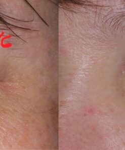 Baebody Eye Gel, Cooling Under Eye Cream For Dark Circles, Puffiness and Bags under Eyes, Eye Cream Anti Aging & Hydrating, Eye Brightening Night Eye Cream - Beauty Gifts for Women 1.7 Fl Oz (Pack of 1) 37 71bNybeMbAL