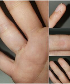 Compound W Maximum Strength Fast Acting Gel Wart Remover, 0.25 oz, 2 Pack unflavored 0.5 Ounce (Pack of 1) 50 71bgDPFN 0L