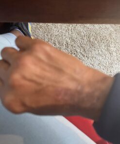 SkinSmart Antimicrobial Eczema Therapy with Hypochlorous Acid, Removes Bacteria so Skin Can Heal, for Adults, Kids and Seniors, 8 Ounce Clear Spray 8 Fl Oz (Pack of 1) 51 71bzmkPgOAL