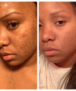 Sports Research Evening Primrose Supplement from Cold Pressed Oil - Softgels for Women’s Health & Skin Health - Gluten Free & Non-GMO GLA - High Potency 1300mg, 120 Count 120 Count (Pack of 1) 35 71cJ7rS3hgL 2