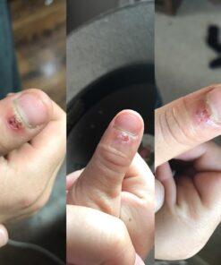 Dr. Nordyke's Wound Honey New Zealand Manuka Honey for Infections,Burns,Cuts and Scars (80g) 2.8 Ounce (Pack of 1) 29 71cRumP1u9L