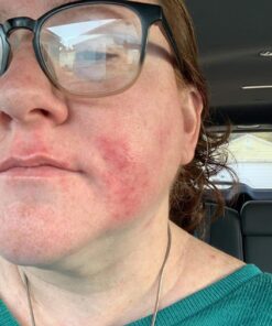 Hydrating Face Moisturizer & Body Cream with Manuka Honey Cream - Organic Face Moisturizer & Body Lotion for Extremely Dry Skin - For Dry & Itchy Skin, Rosacea & Eczema Prone Skin (Original, 2oz) Original 2 Ounce (Pack of 1) 29 71cmzC8jHnL 1