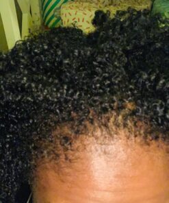 Thick Hair Growth Vitamins– Hair Growth Pills With DHT Blocker Stimulates Faster Hair Growth for Weak, Thinning Hair–Biotin Hair Supplements with Keratin & Collagen Helps Men&Women Grow Perfect Hair. 60 Count (Pack of 1) 37 71d4JKwXpbL