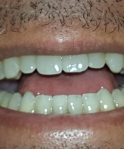 Zen Charcoal Hardwood Activated Charcoal Powder, 100% USA Trees, 8 oz 8 Ounce (Pack of 1) 38 71dHkSzj6VL