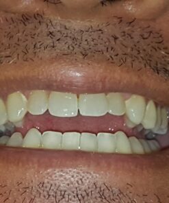 Zen Charcoal Hardwood Activated Charcoal Powder, 100% USA Trees, 8 oz 8 Ounce (Pack of 1) 39 71dpnTYezfL