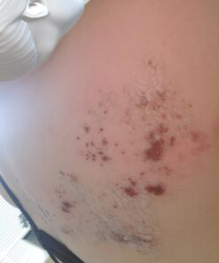 RMR-86 Instant Mold Stain and Mildew Stain Remover Spray - Scrub Free Formula, 32 Fl Oz 32 Fl Oz (Pack of 1) 36 71efNQx0rL