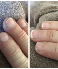 Gloves In A Bottle Shielding Lotion (One- 2 fl oz-60 ml & One - 8 fl oz-240 ml) With Pump Great for Dry Itchy Skin! Grease-less and Fragrance Free! 32 71eplOhtiSL 1