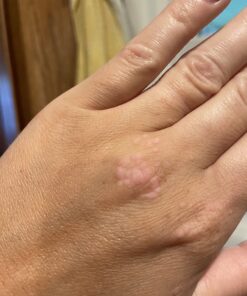 Compound W Maximum Strength Fast Acting Gel Wart Remover, 0.25 oz, 2 Pack unflavored 0.5 Ounce (Pack of 1) 47 71f2eS1clyL