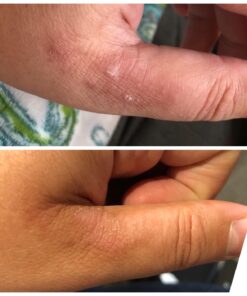 MG217 Psoriasis Treatment, Medicated Conditioning 2% Coal Tar Multi-Symptom Ointment, 3.8 Ounce Discontinued 3.8 Ounce 21 71fCJ1GneL