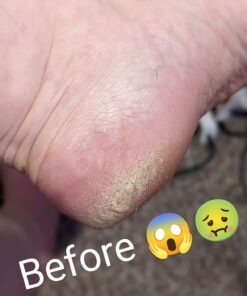 Microplane Colossal Foot File Scraper - The Original Stainless Steel Foot Rasp, Dead Skin/Callus Remover for Feet, Gentle Foot Scrubber, Pedicure Tools for Salon-Quality Foot Care, Black 80 71fGamPCkL