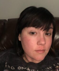 Artnaturals Rosehip Seed Oil 4 oz for Face, Hair & Skin - 100% Pure Natural, Cold Pressed & Unrefined Rose Hip Oil - Anti-Aging Moisturizer Facial Oil for Fine Lines, Scars & Wrinkles 57 71fMxR5jUvL 2