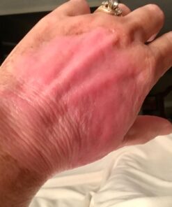 Silver Miracles Colloidal Silver Gel - Nano Silver Gel Wound Care - Healing Ointment for Burns, Sunburns & Irritated Skin - 4 Oz Unscented 47 71fWTHxkbrL