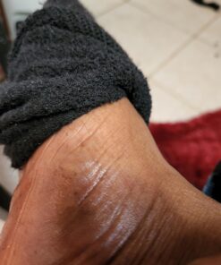 Dr. Nordyke's Wound Honey New Zealand Manuka Honey for Infections,Burns,Cuts and Scars (80g) 2.8 Ounce (Pack of 1) 21 71fYhYW7SvL