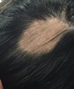 Naturenetics HairAnew Hair Growth Vitamins for Women & Men - Hair Vitamins For Faster Hair Growth & Thickness - Part of Proceeds go to Hair Loss Charity - Vegan Hair Supplement For Hair Skin Nails (1) 1 36 71gDU7C9ztL