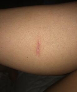 Active Skin Repair Hydrogel - Natural & Non-Toxic First Aid Ointment & Antiseptic Gel for Minor Cuts, Wounds, Scrapes, Rashes, Sunburns, and Other Skin Irritations (Single, 3 oz Gel) 3 Fl Oz (Pack of 1) 51 71gLAGtdg L