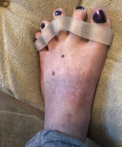 YOGABODY Naturals Toe Spreaders & Separators, Fast Pain Relief from Hammertoe & Bunions, Two Pairs in Stylish Wooden Box, Latex-Free Rubber Toe Stretchers Used for Walking, Running & Yoga Practice 24 71gOkziB0RL