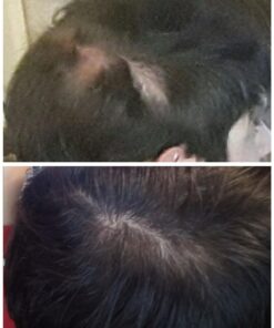 Propidren by HairGenics - DHT Blocker & Hair Growth Capsules to Prevent Hair Loss & Stimulate Hair Follicles, to Stop Hair Loss & Regrow Hair. Proprietary Anti-Hair Loss & Hair Regrowth Treatment. 32 71h3txyMuVL 1