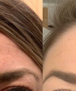 Hyaluronic Acid Serum for Skin 100% Pure Anti Aging Serum Intense Hydration Moisture Non greasy Paraben free, Wrinkle Reducing and Brightening Serum (Pro Formula) 2oz 2 Fl Oz (Pack of 1) 38 71h5HK594YL