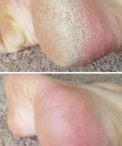 Microplane Colossal Foot File Scraper - The Original Stainless Steel Foot Rasp, Dead Skin/Callus Remover for Feet, Gentle Foot Scrubber, Pedicure Tools for Salon-Quality Foot Care, Black 72 71h7fcckSeL